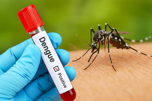 Dengue Fever